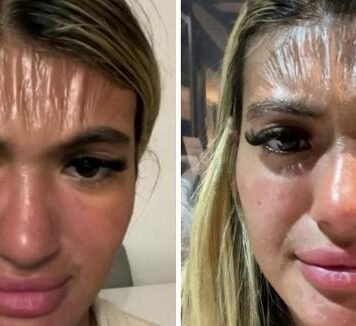 সূর্যালোকে কপাল প্লাস্টিকের মতো সঙ্কুচিত হয়ে যায়!